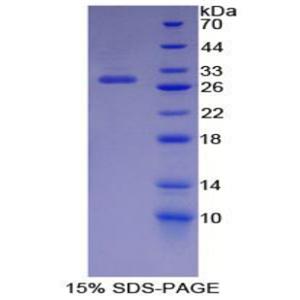 周期素依赖性激酶9(CDK9)重组蛋白