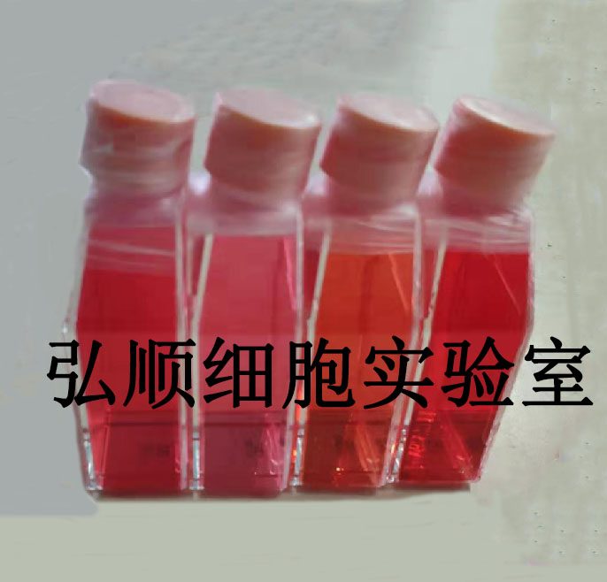 AN3-CA Cells|人子宫内膜腺癌贴壁细胞,AN3-CA Cells