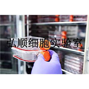 ACC-3 Cells|人涎腺腺样囊性癌贴壁细胞