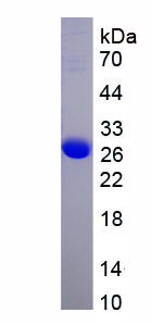 周期素依赖性激酶5(CDK5)重组蛋白,Recombinant Cyclin Dependent Kinase 5 (CDK5)