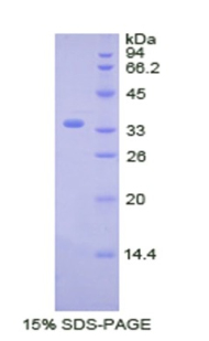 周期素依賴性激酶4(CDK4)重組蛋白,Recombinant Cyclin Dependent Kinase 4 (CDK4)