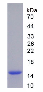 周期素依賴性激酶1(CDK1)重組蛋白,Recombinant Cyclin Dependent Kinase 1 (CDK1)