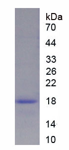 肿瘤易感基因101(TSG101)重组蛋白,Recombinant Tumor Susceptibility Gene 101 (TSG101)