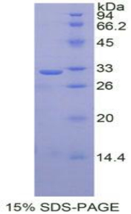 肿瘤调节蛋白1(TR1)重组蛋白,Recombinant Tomoregulin 1 (TR1)