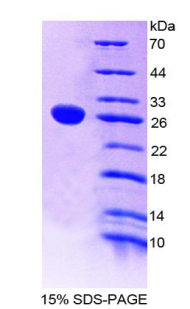 肿瘤坏死因子受体超家族成员1B(TNFRSF1B)重组蛋白,Recombinant Tumor Necrosis Factor Receptor Superfamily, Member 1B (TNFRSF1B)