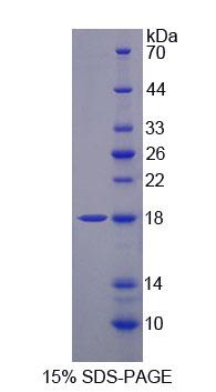 肿瘤坏死因子受体超家族成员14(TNFRSF14)重组蛋白
