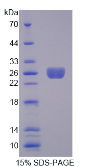 腫瘤壞死因子配體超家族成員9(TNFSF9)重組蛋白,Recombinant Tumor Necrosis Factor Ligand Superfamily, Member 9 (TNFSF9)