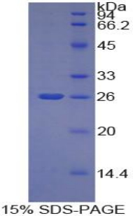 肿瘤坏死因子配体超家族成员14(TNFSF14)重组蛋白,Recombinant Tumor Necrosis Factor Ligand Superfamily, Member 14 (TNFSF14)