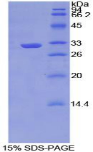 肿瘤坏死因子α诱导蛋白3相互作用蛋白2(TNIP2)重组蛋白,Recombinant Tumor Necrosis Factor Alpha Induced Protein 3 Interacting Protein 2 (TNIP2)