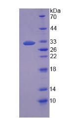 肿瘤蛋白p53结合蛋白1(TP53BP1)重组蛋白,Recombinant Tumor Protein p53 Binding Protein 1 (TP53BP1)