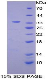 中性粒细胞特异性抗原1(NB1)重组蛋白,Recombinant Neutrophil Specific Antigen 1 (NB1)