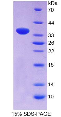 中心粒旁素(PCNT)重组蛋白,Recombinant Pericentrin (PCNT)