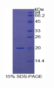 中期因子(MK)重组蛋白,Recombinant Midkine (MK)