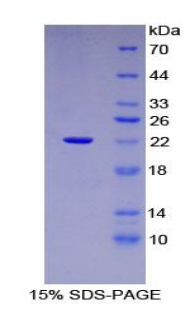 中脑星形胶质细胞来源神经营养因子(MANF)重组蛋白,Recombinant Mesencephalic Astrocyte Derived Neurotrophic Factor (MANF)