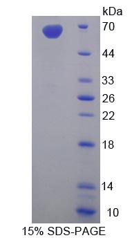 中间丝蛋白(SYNC)重组蛋白,Recombinant Syncoilin (SYNC)