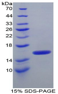 中间α-球蛋白抑制因子H4(ITIH4)重组蛋白,Recombinant Inter Alpha-Globulin Inhibitor H4 (ITIH4)