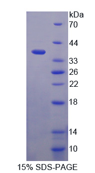 中間α-球蛋白抑制因子H1(ITIH1)重組蛋白,Recombinant Inter Alpha-Globulin Inhibitor H1 (ITIH1)