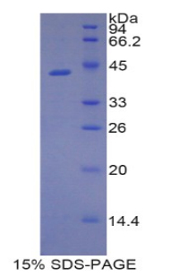 脂質(zhì)運(yùn)載蛋白9(LCN9)重組蛋白,Recombinant Lipocalin 9 (LCN9)