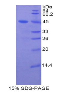 脂质运载蛋白8(LCN8)重组蛋白,Recombinant Lipocalin 8 (LCN8)