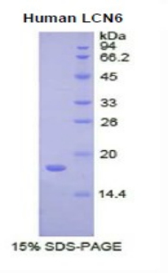 脂质运载蛋白6(LCN6)重组蛋白,Recombinant Lipocalin 6 (LCN6)