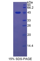 脂质运载蛋白5(LCN5)重组蛋白,Recombinant Lipocalin 5 (LCN5)