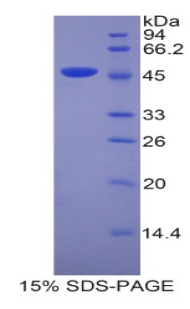 脂质运载蛋白4(LCN4)重组蛋白,Recombinant Lipocalin 4 (LCN4)