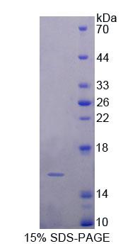 脂肪細(xì)胞型脂肪酸結(jié)合蛋白(FABP4)重組蛋白,Recombinant Fatty Acid Binding Protein 4 (FABP4)