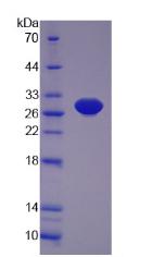 脂肪细胞膜关联蛋白(APMAP)重组蛋白,Recombinant Adipocyte Plasma Membrane Associated Protein (APMAP)