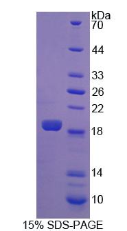 脂肪酸去飽和酶2(FADS2)重組蛋白,Recombinant Fatty Acid Desaturase 2 (FADS2)