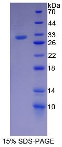 脂多糖結(jié)合蛋白(LBP)重組蛋白,Recombinant Lipopolysaccharide Binding Protein (LBP)