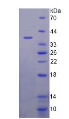 脂蛋白a(Lpa)重组蛋白,Recombinant Lipopolysaccharide Binding Protein (LBP)