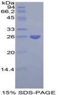 正五聚蛋白3(PTX3)重組蛋白,Recombinant Pentraxin 3, Long (PTX3)