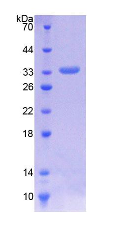 整合素連鎖激酶(ILK)重組蛋白,Recombinant Integrin Linked Kinase (ILK)