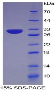 著絲粒蛋白I(CENPI)重組蛋白,Recombinant Centromere Protein I (CENPI)