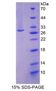 着丝粒蛋白F(CENPF)重组蛋白,Recombinant Centromere Protein F (CENPF)