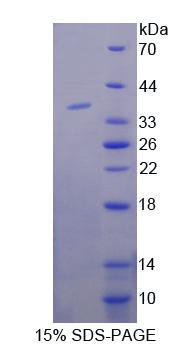 张力蛋白3(TNS3)重组蛋白,Recombinant Tensin 3 (TNS3)