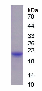 粘蛋白5AC(MUC5AC)重组蛋白,Recombinant Mucin 5 Subtype AC (MUC5AC)