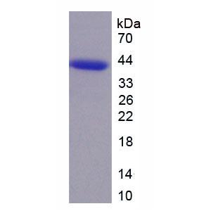 周期素依赖性激酶6(CDK6)重组蛋白,Recombinant Cyclin Dependent Kinase 6 (CDK6)