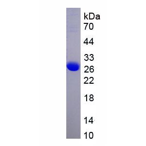 周期素依赖性激酶5(CDK5)重组蛋白