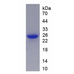 周期素依赖性激酶2(CDK2)重组蛋白