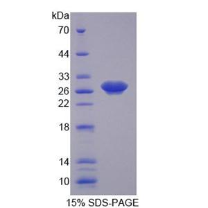 周期素依赖性激酶16(CDK16)重组蛋白