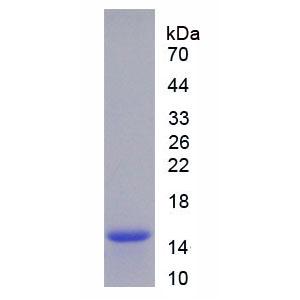 周期素依赖性激酶1(CDK1)重组蛋白,Recombinant Cyclin Dependent Kinase 1 (CDK1)