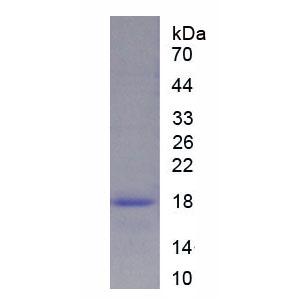 肿廇蛋白P63(TP63)重组蛋白,Recombinant Tumor Protein P63 (TP63)