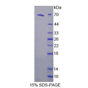 肿瘤坏死因子受体超家族成员10C(TNFRSF10C)重组蛋白,Recombinant Tumor Necrosis Factor Receptor Superfamily, Member 10C (TNFRSF10C)