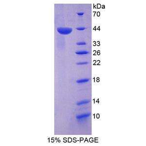 肿瘤蛋白p53(TP53)重组蛋白