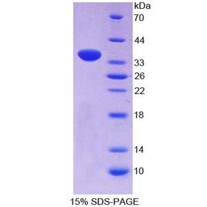 中心粒旁素(PCNT)重组蛋白,Recombinant Pericentrin (PCNT)