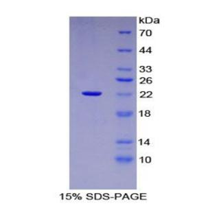 中间小电导钙激活钾离子通道亚家族N成员2(KCNN2)重组蛋白