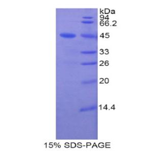 脂质运载蛋白8(LCN8)重组蛋白,Recombinant Lipocalin 8 (LCN8)