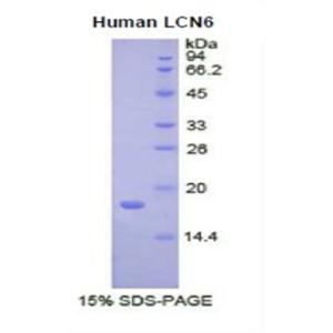 脂质运载蛋白6(LCN6)重组蛋白