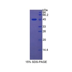 脂质运载蛋白5(LCN5)重组蛋白,Recombinant Lipocalin 5 (LCN5)